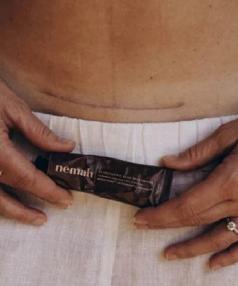 Restorative Scar Treatment (Nemah)